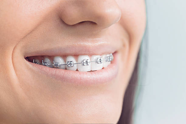 Best Wisdom Tooth Removal  in Opelousas, LA